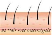 Be Hair Free Electrolysis